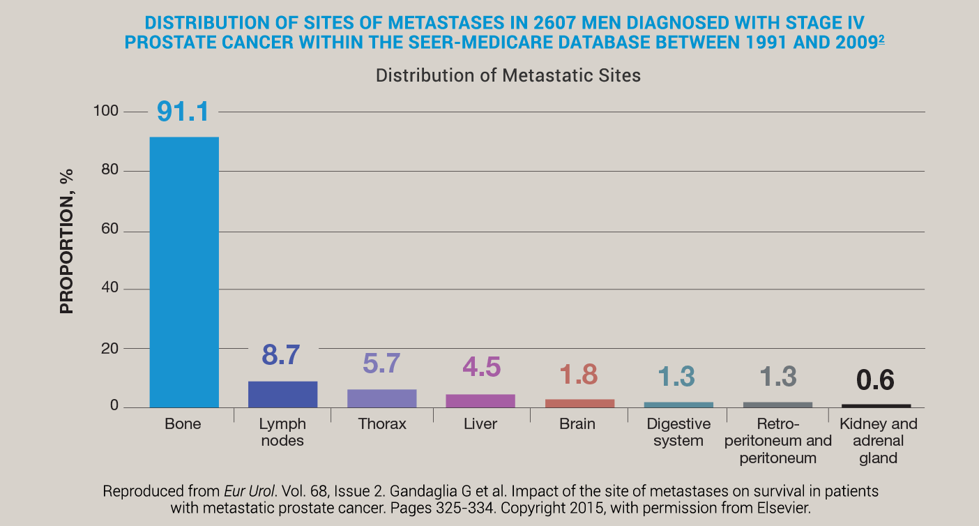 Distribution of sites...